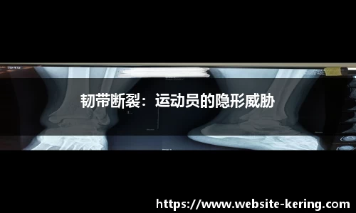韧带断裂：运动员的隐形威胁